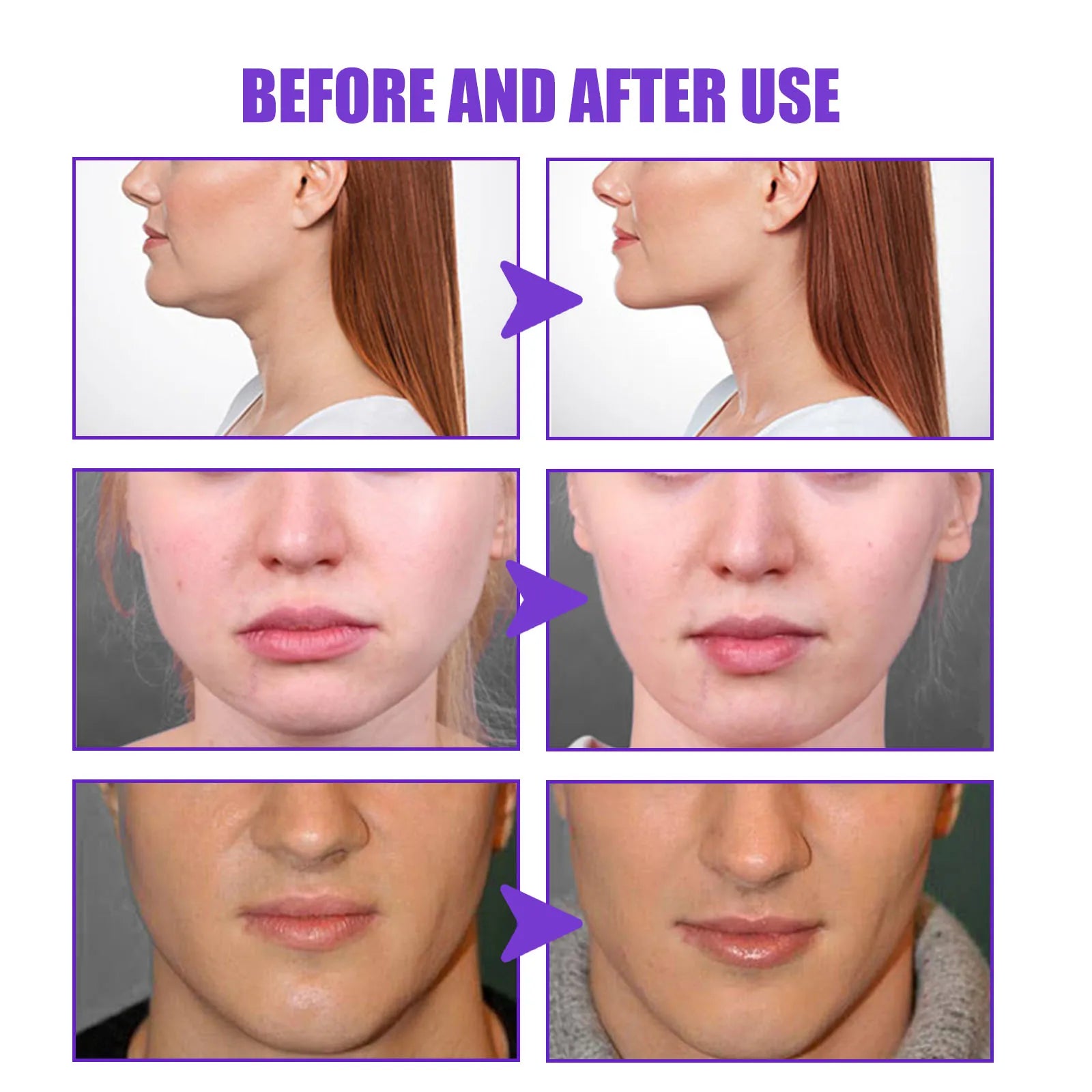 V-Shape Slimming Cream Tighten Mandibular Line Double Chin Lift Firming Face Fat Burning Massage V Face Cream Facial Skin Care Qme