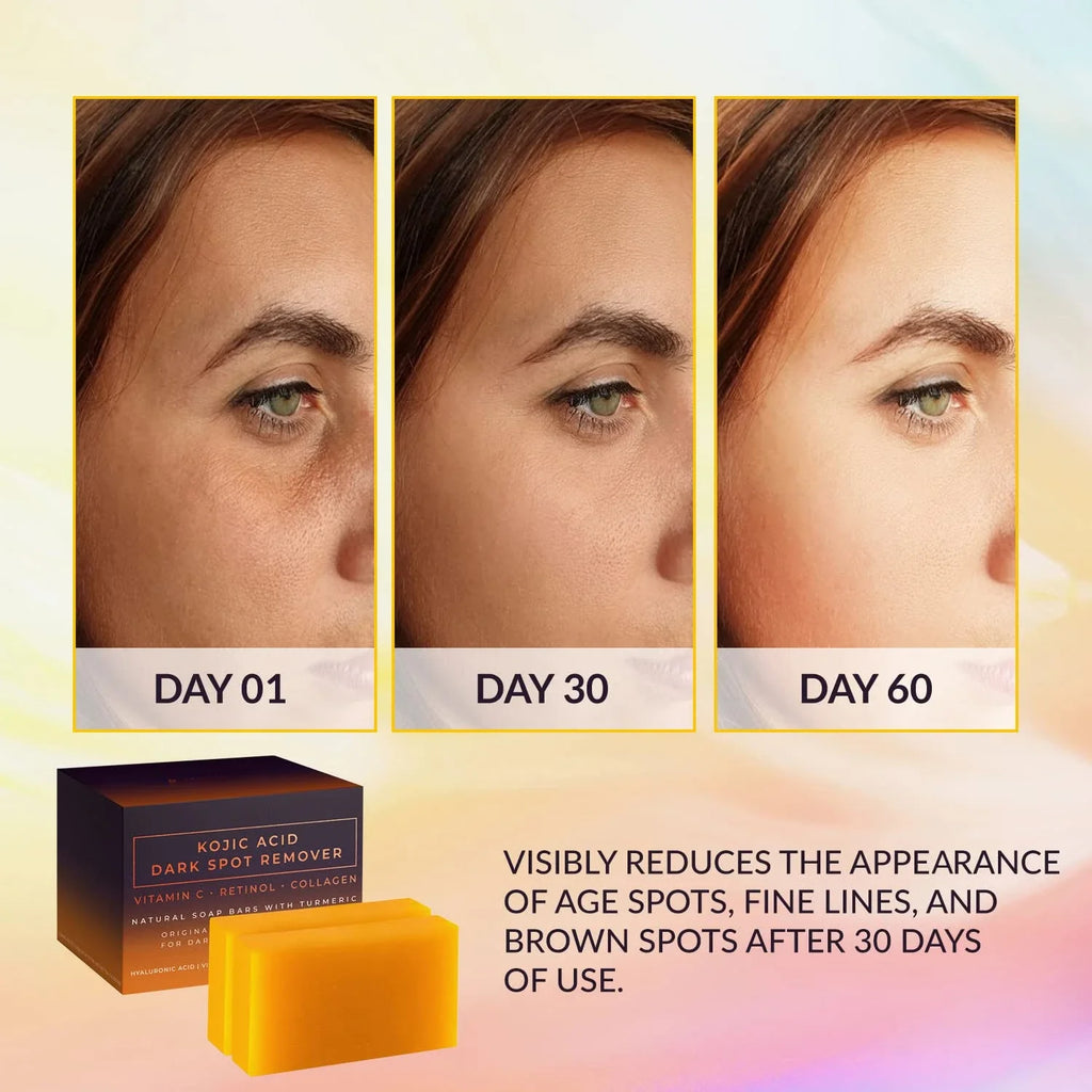 Kojic Acid Dark Spot Remover Whitening Soap Handmade Skin Care Deep Cleaning Moisturizing Cleansing Essential Soap Brighten Skin Qme