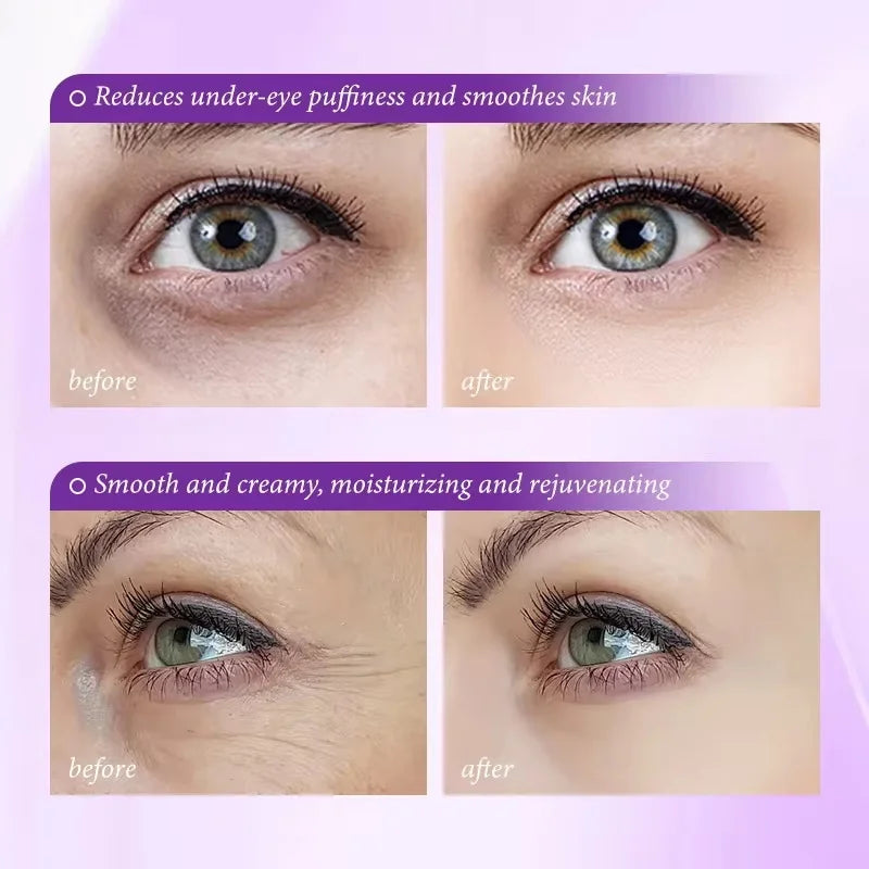 Instant Eye Bag Removal Cream Collagen Anti-Wrinkle Fade Fine Lines Firming Skin Anti Dark Circle Puffiness Brighten Eye Care Qme