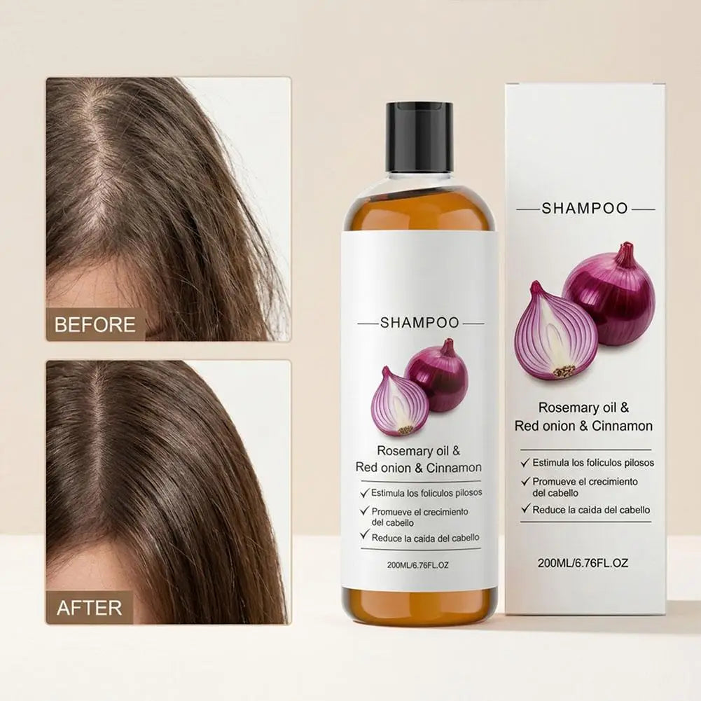 Rosemary Red Onion Shampoo/Conditioner Anti Hair Loss Promote Thicker Stronger excalvo Shampoo/Conditioner Hair Care Qme