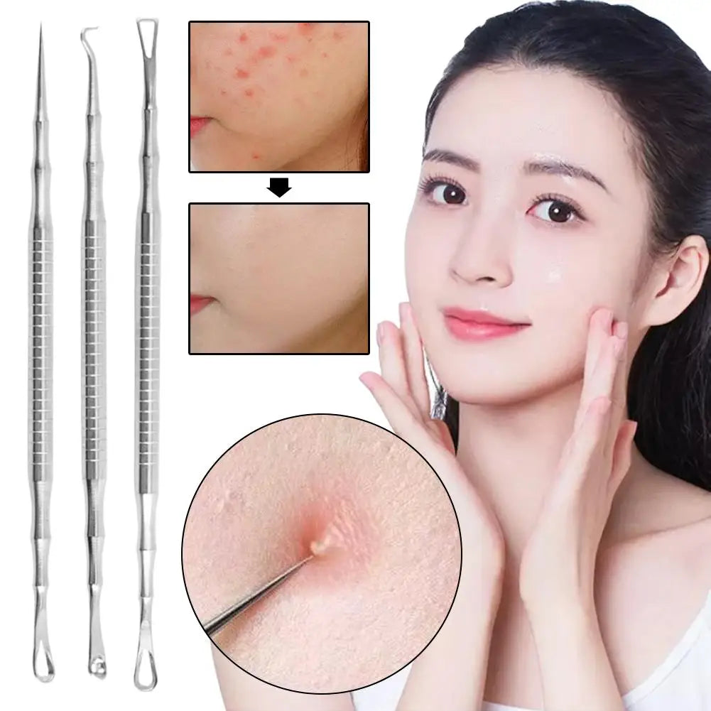 Pimple Extractor Acne Needle Tool Blackhead Comedone Removal Popper Qme