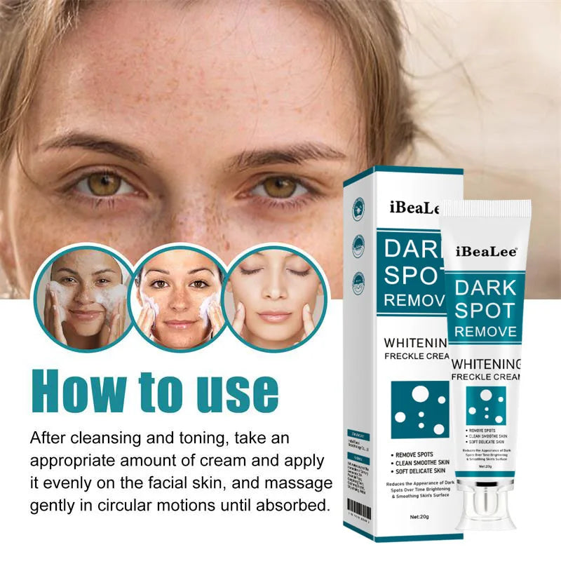 Melasma Brightening Face Cream Niacinamide Serum Brighten Cream Fade Fine Lines Lighten Dark Dot Reduce Melanin Face Skincare Qme