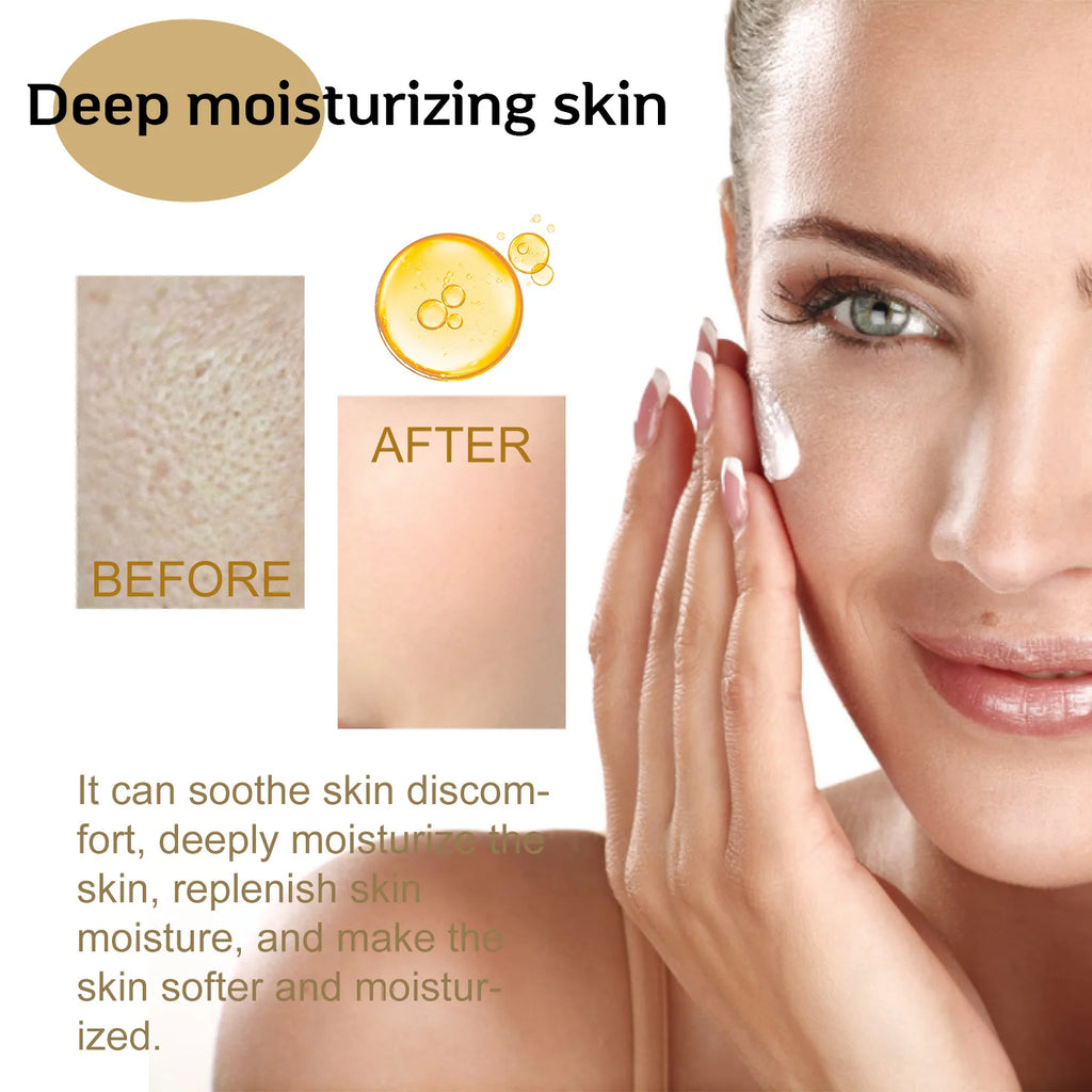 Centella Serum Nourish Improvement Dry Skin Smoothing Rejuvenation Brighten Moisturizing Hyaluronic Acid Face Essence Skin Care Qme