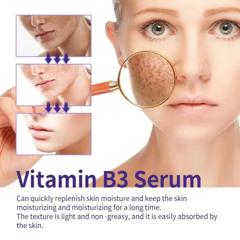 Niacinamide Facial Serum Vitamin B3 Wrinkles Pigment Dark Spot Removal Correcting Glow Serum Face Whitening Moisturizer Serum Qme