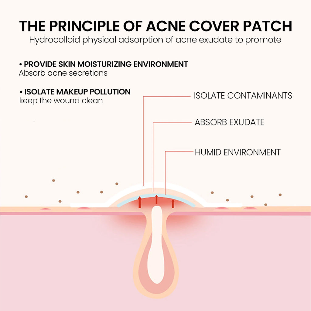 200Pcs Repair Acne Patch Fade Blemishes Pimple Marks Closed Acne Blemishes Hydrocolloid Star Shaped Cover Acne Pimple Patch Qme