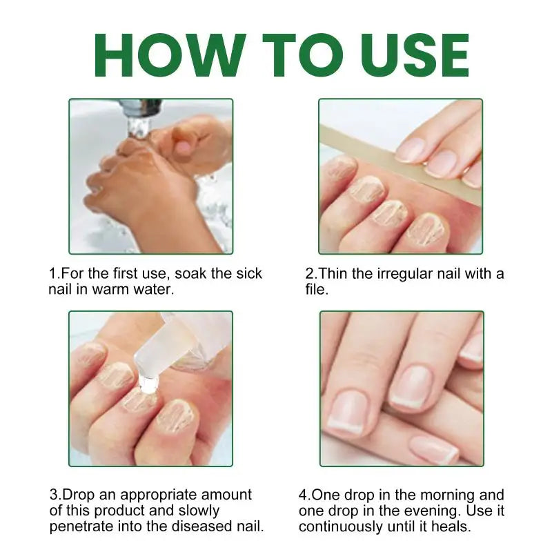 Nail Fungus Device Toenail Fingernail Restoration Onychomycosis Qme