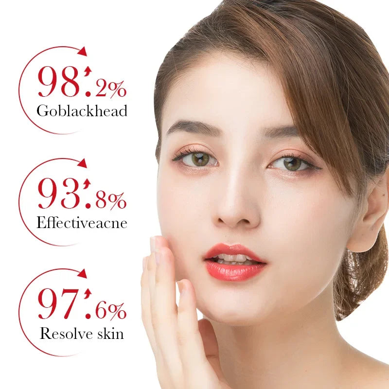 BIOAQUA Salicylic Acid Acne Removing Essence Face Serum Skincare Qme