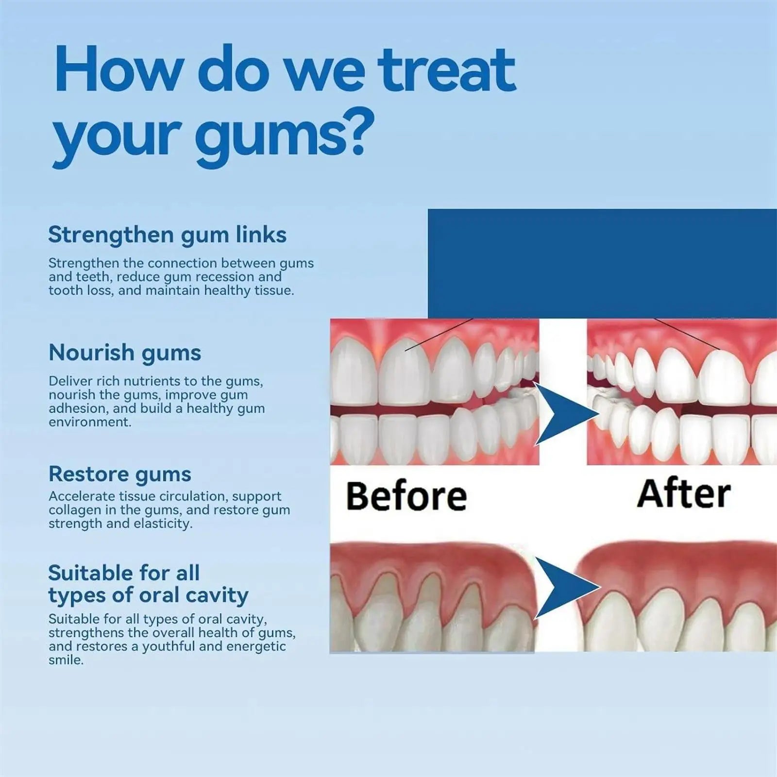 Damaged Gum Repair Care Toothpaste Relieve Sore Gums Allergy Deep Cleaning Teeth Stains Tartar Serum Dental Caries Toothpaste Qme