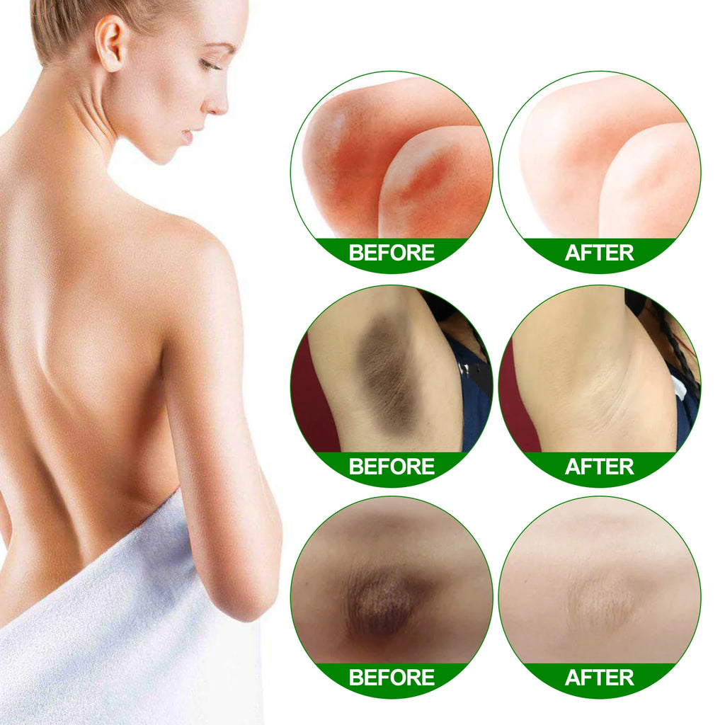Retinol Whitening Cream for Dark Skin Knee Buttocks Underarm Butt Inner Brightening Private Part Remove Melanin Bleaching Cream Qme