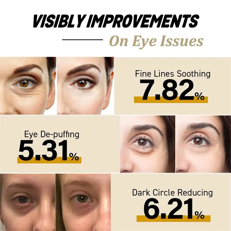 Retinol Eye Cream Remove Dark Circles Eye Bags Puffiness Reduces Wrinkle Eye Serum Stick Dark Circles Removal Man Woman Eye Care Qme