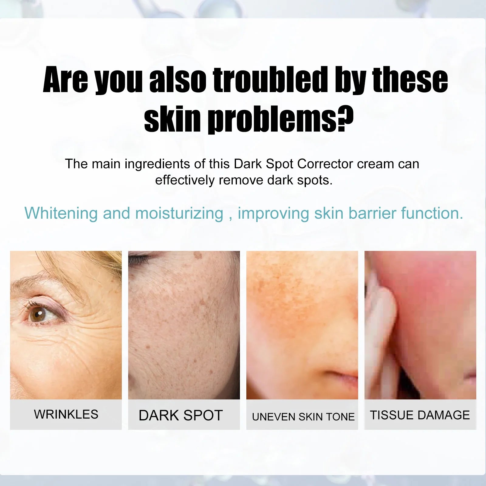 Freckle Whitening Cream Nicotinamide Fade Dark Spot Blemish Acne Mark Brightening Lightening Pigmentation Correction Cream Qme
