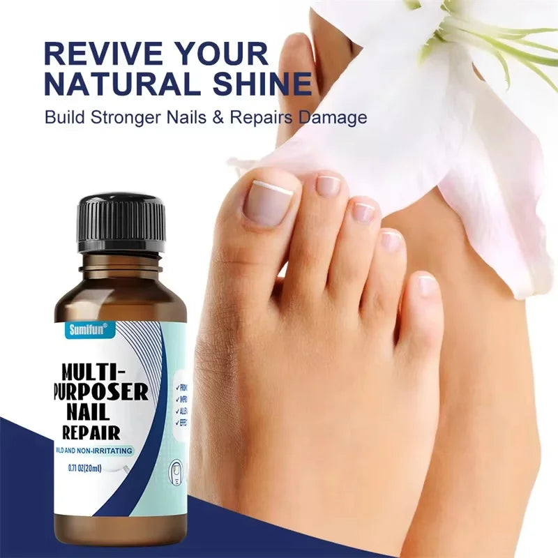 Fungal Nail Treatment Serum Foot Nail Fungus Removal Repair Gel Anti Infection Paronychia Onychomycosis Foot Nails Care Essence Qme