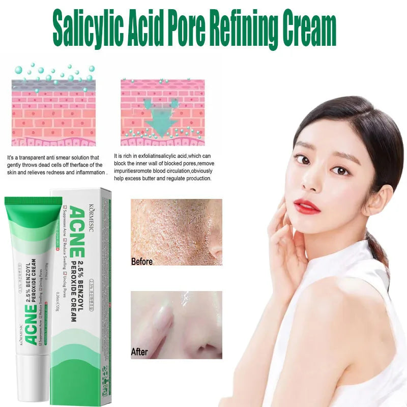 Salicylic Acid Pore Clearing Cream Shrink Pores Remove Blackheads Acne Brighten Moisturizing Smooth Skin Care Korean Products Qme