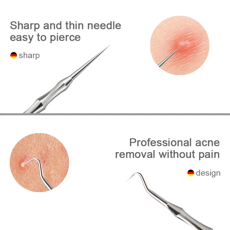 Acne Blackhead Removal Needles Pimples Clip Tweezers Beauty Artifact Qme