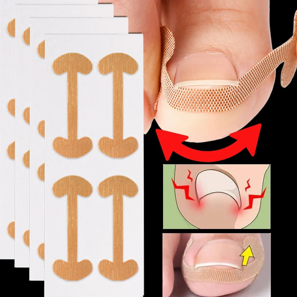 100PCS Ingrown Toenail Correction Strips Lasting Adhesion Waterproof Nail Correction Stickers Elasticity Toe Care Pedicure Tools Qme