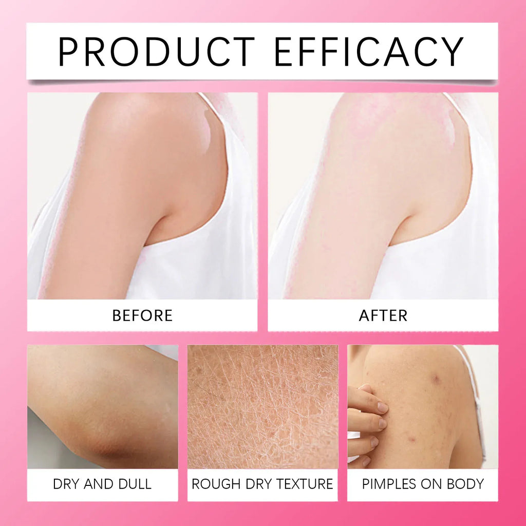 Whitening Body Cream For Dark Skin Armpit Thigh Inner Joint Fade Intimate Area Underarm Body Care Private Part Brighten Lotion Qme