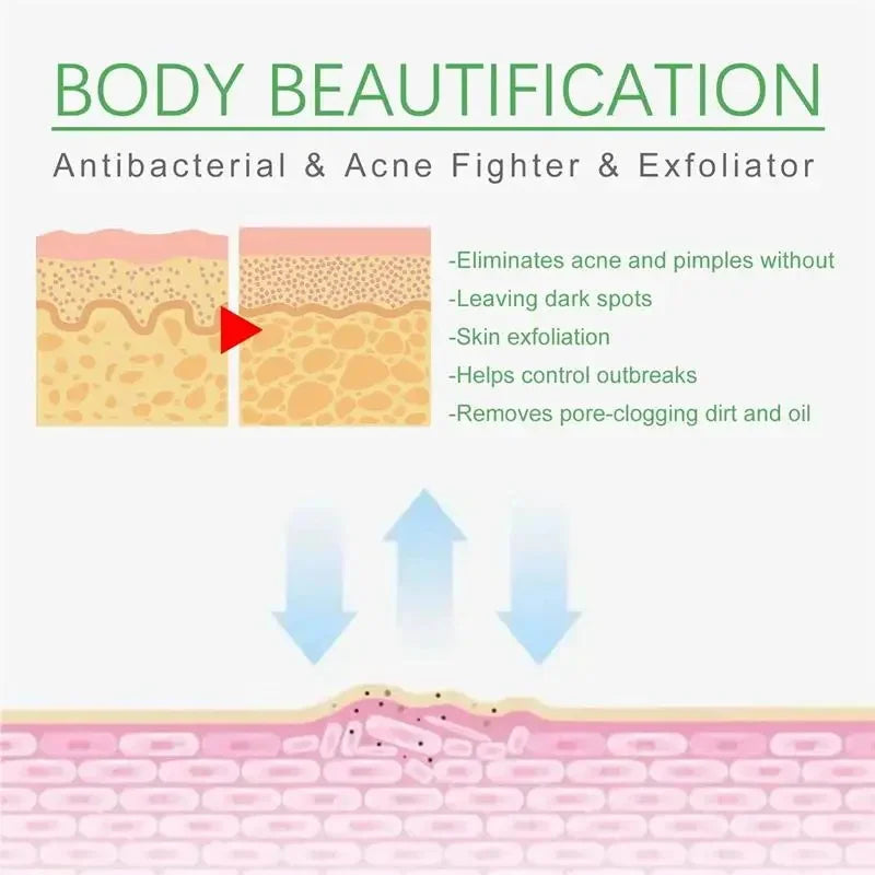 Salicylic Acid Acne Treatment Face Cream Repair Pimple Spots Deep Cleaning Pore Anti-acne Scar Oil Control Moisturizer Skin Care Qme