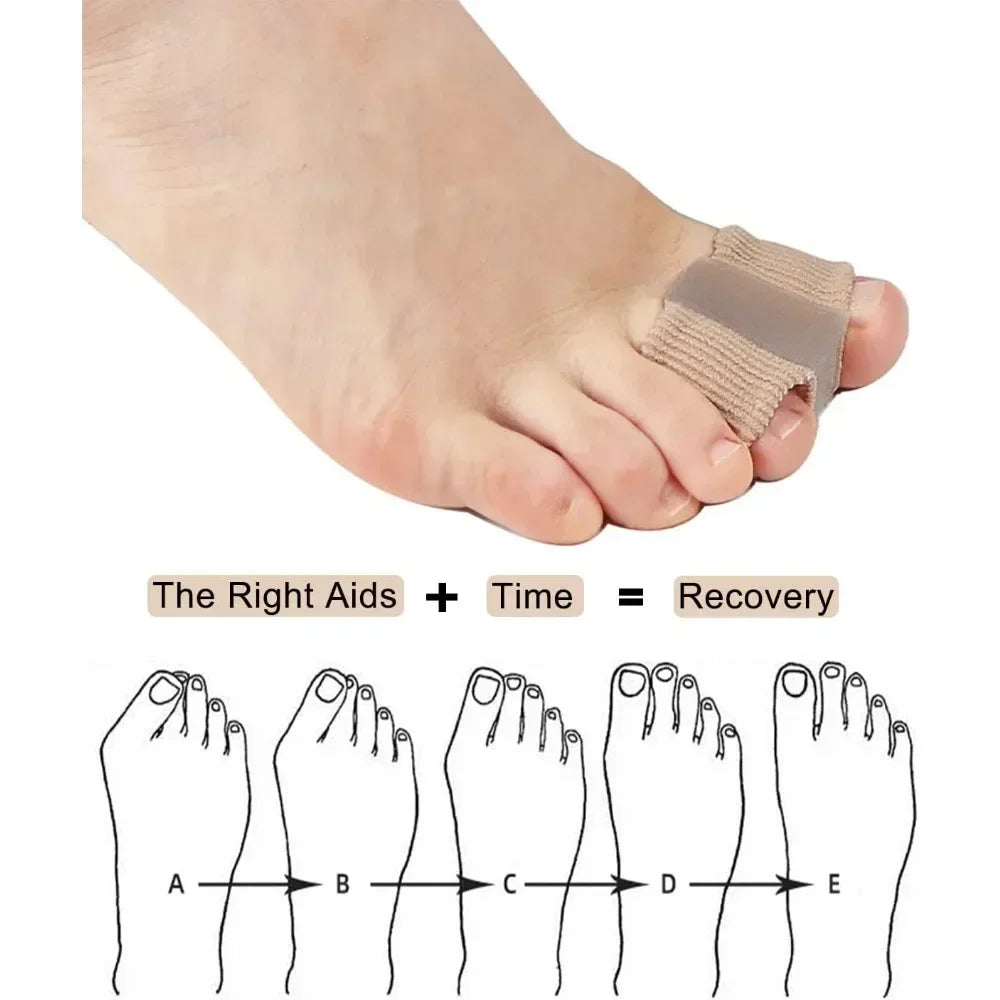 1/2Pc Two Toe Separator Hallux Valgus Bunion Corrector Orthotics Feet Bone Thumb Adjuster Correction Pedicure Feet Straightener Qme