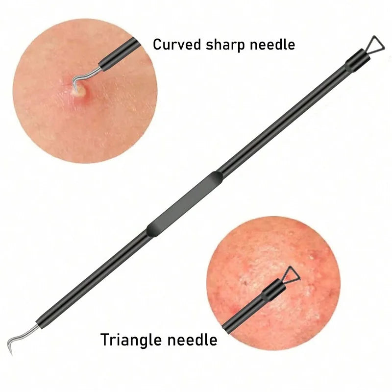 Pimple Popper Tool Blackhead Remover Acne Needle Tools Removing Care Qme