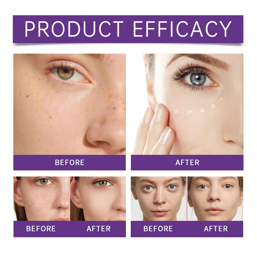 Concealer Improve Skin Elasticity Brighten Complexion Not Easy Remove Makeup Moisturizing Liquid Lightweight Dark Circle Blemish Qme