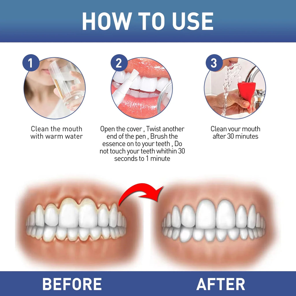 Damaged Gum Repair Care Gel Relieve Sore Gums Allergy Deep Cleaning Teeth Stains Tartar Serum Dental Caries Toothpaste Qme