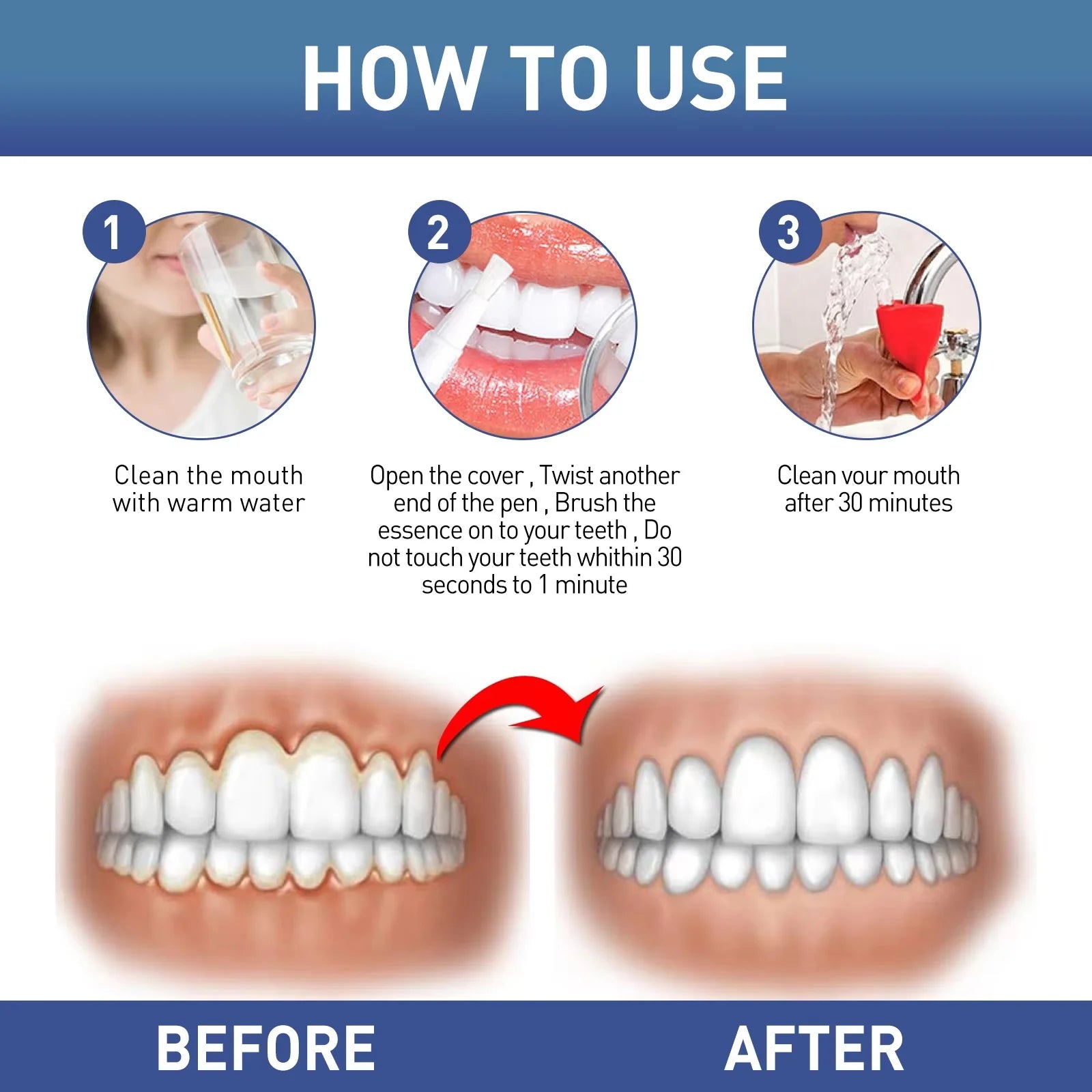 Damaged Gum Repair Care Gel Relieve Sore Gums Allergy Deep Cleaning Teeth Stains Tartar Serum Dental Caries Toothpaste Qme