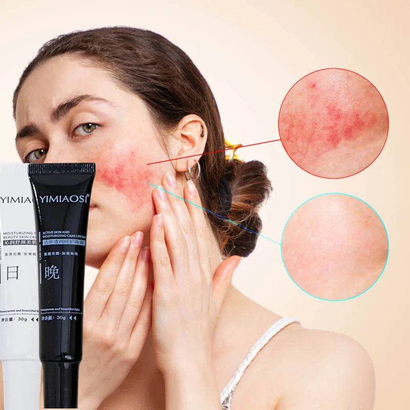 Facial Redness Repair Cream Improve Sensitive Skin Dryness Hydrating Sooth Lotion Removal Rosacea Day Night Korean Cosmetics Qme