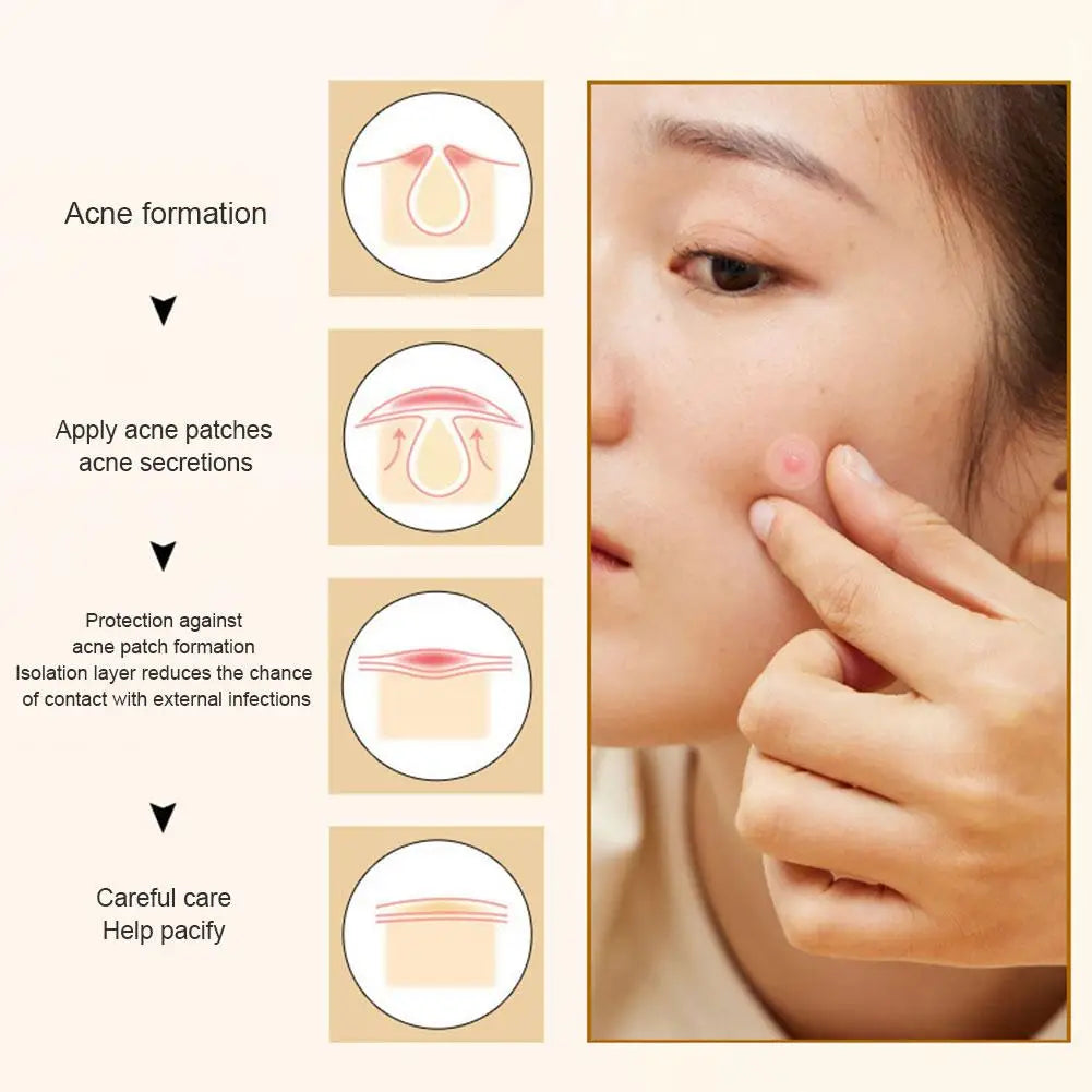 35/40Pcs Colorful Cute Star Heart Shaped Acne Treatment Sticker Invisible Acne Cover Removal Pimple Patch Skin Care Qme