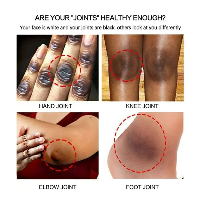 Remove Melanin Nicotinamide Brightening Cream For Dark Skin Effective Lighten Thigh Inner Bleach Private Parts Brighten Cream Qme