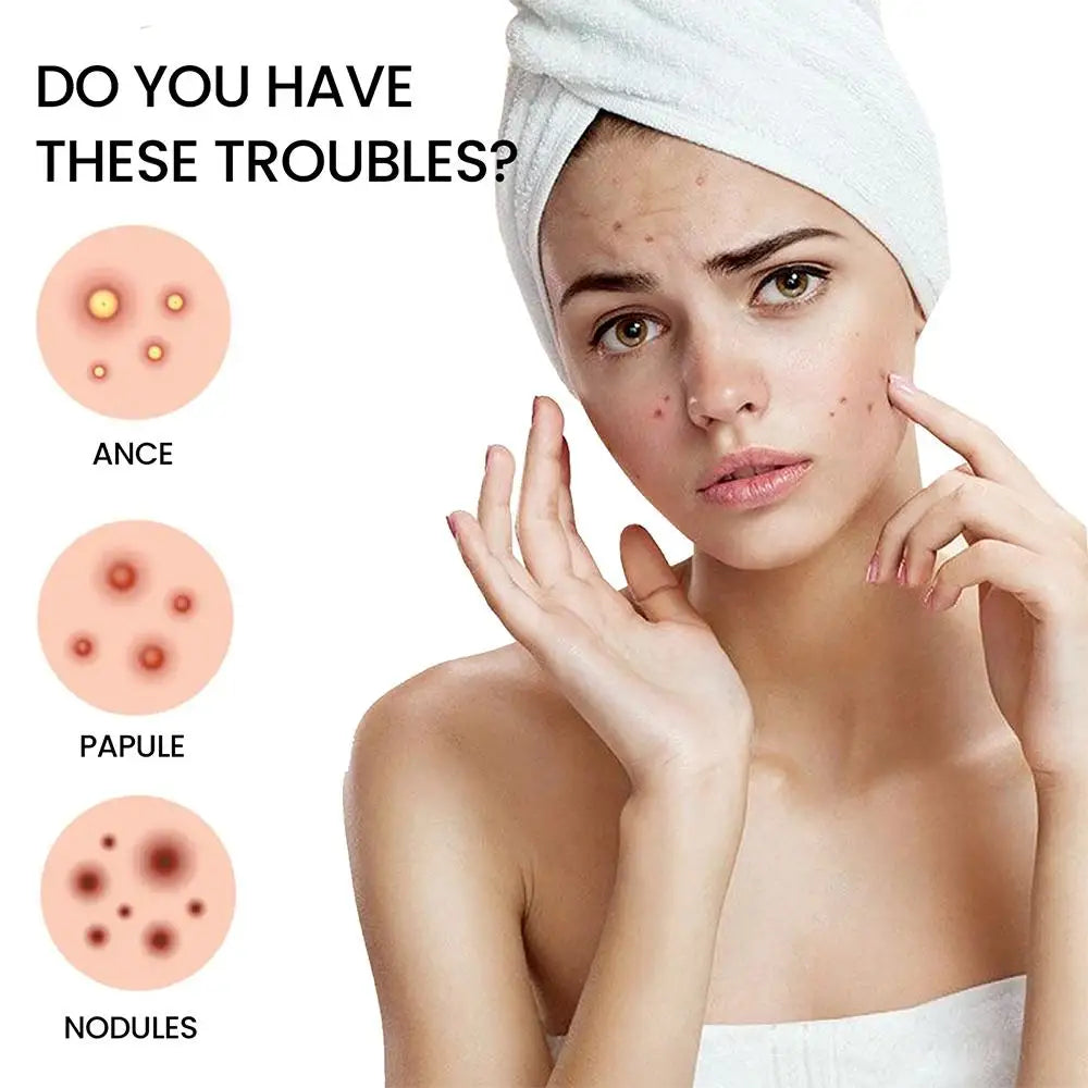 200 Counts Colorful Hydrocolloid Cute Star Shaped Acne Pimple Patch For Face Invisible Zit Cover Stickers Skin Care Qme