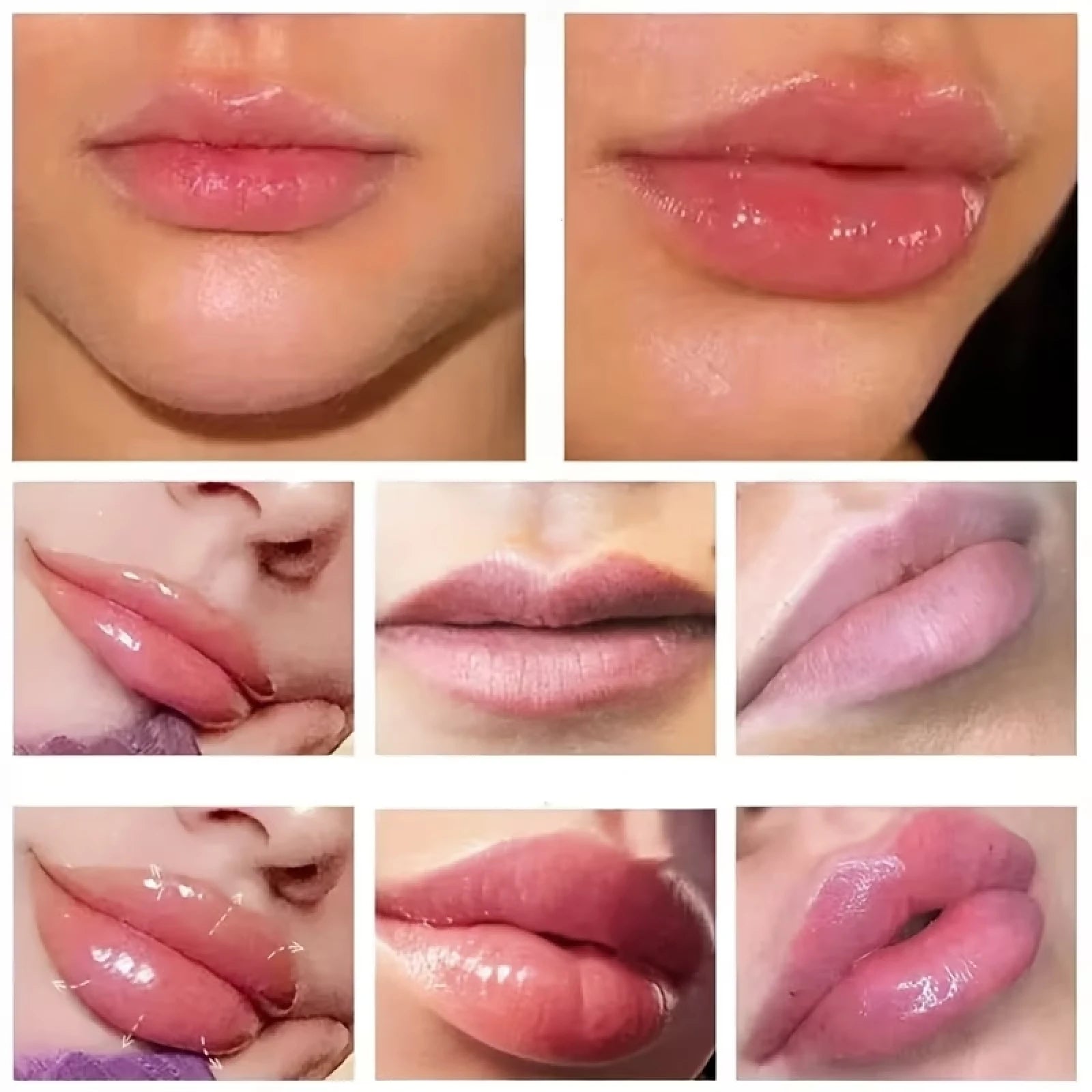 Lip Plumping Cream 10X Extreme Volume, Ultra Hydrating for Tender Lips Qme