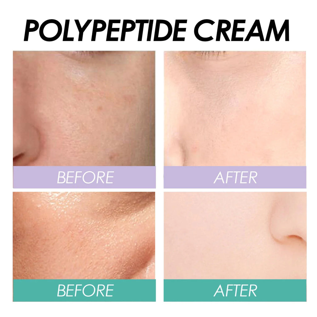 Polypeptide Moisturizing Face Cream Anti-aging Anti-wrinkle Protein Qme