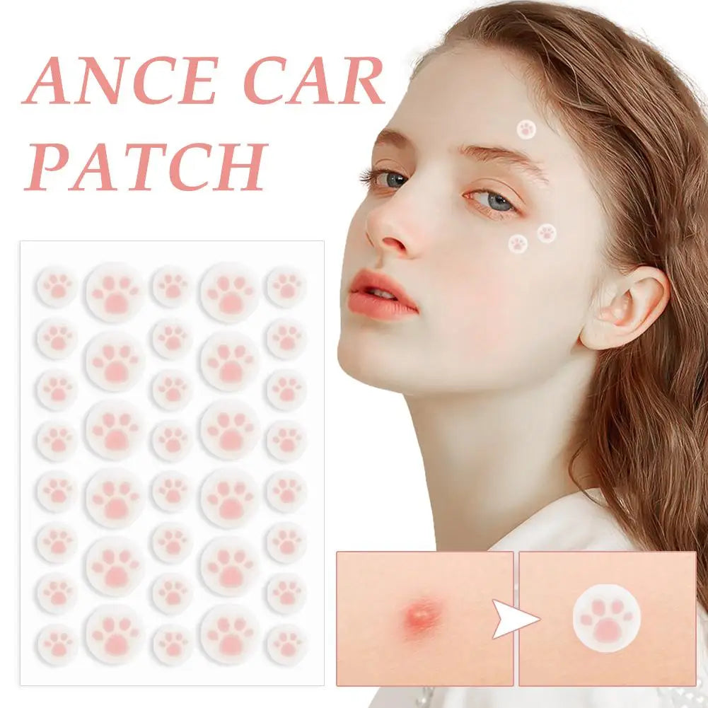 Hydrocolloid Acne Pimple Patch 36 Counts Cute Cat Paws Shaped Acne Absorbing Cover Patch, Invisible For Acne Dots Qme
