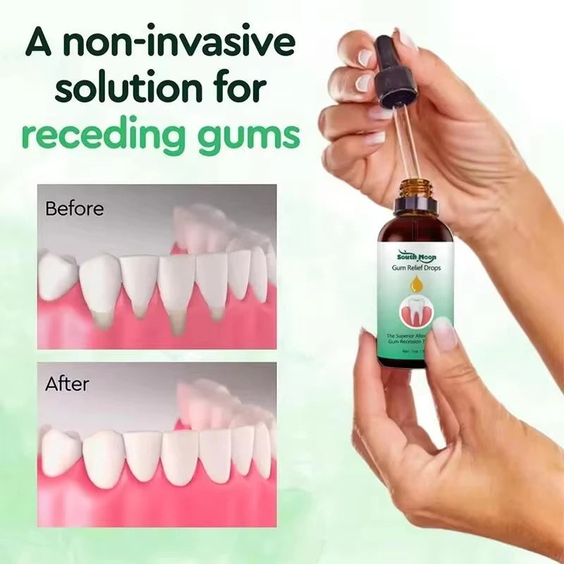 Gum Repair Drops Relieve Receding Gingival Swelling Gum Cleaning Care Oral Periodontal Hygiene Remove Yellow Remove Stain Qme
