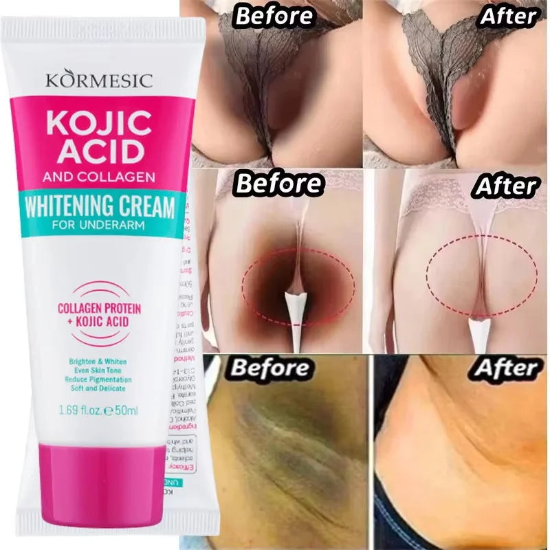 Body Whitening Lotion Dark Spot Remover For Underarms Knees Elbows Melanin Bleaching Lightening Skin Moisturizing Cream Qme