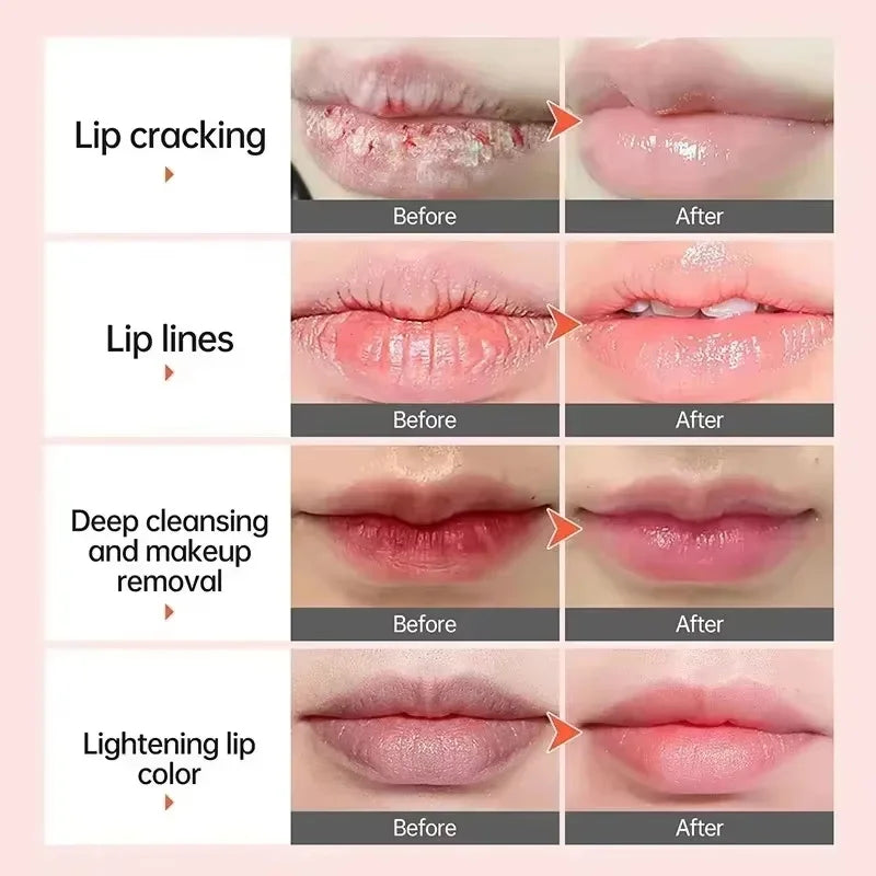 Remove Dark Lip Balm Fast Lightening Pink Lip Exfoliating Fade Lip Line Dead Skin Moisturizer Korean Care Products Beauty Health Qme