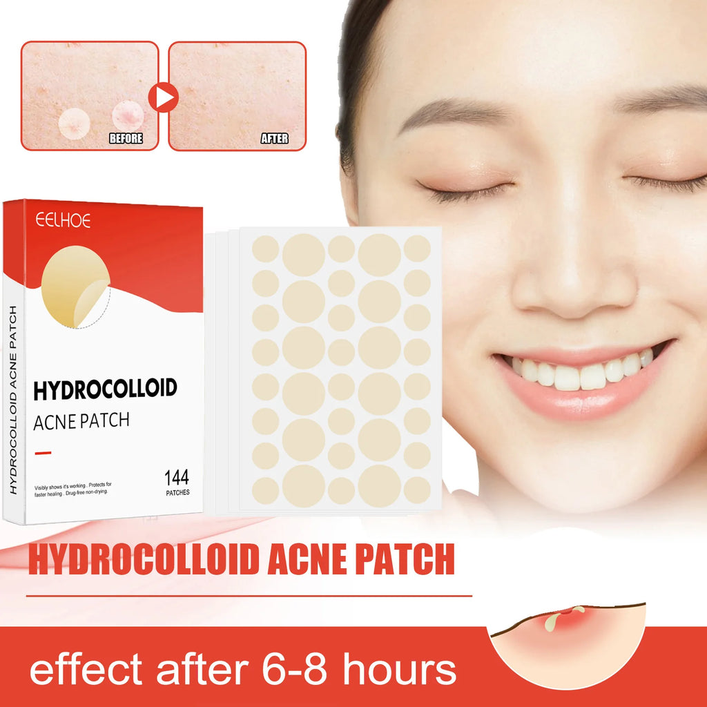 Hydrocolloid Acne Patches 2 Sizes Invisible Makeup-Friendly Face Care Acne Pimple Patch Breathable for Comedones Spot Treatment Qme