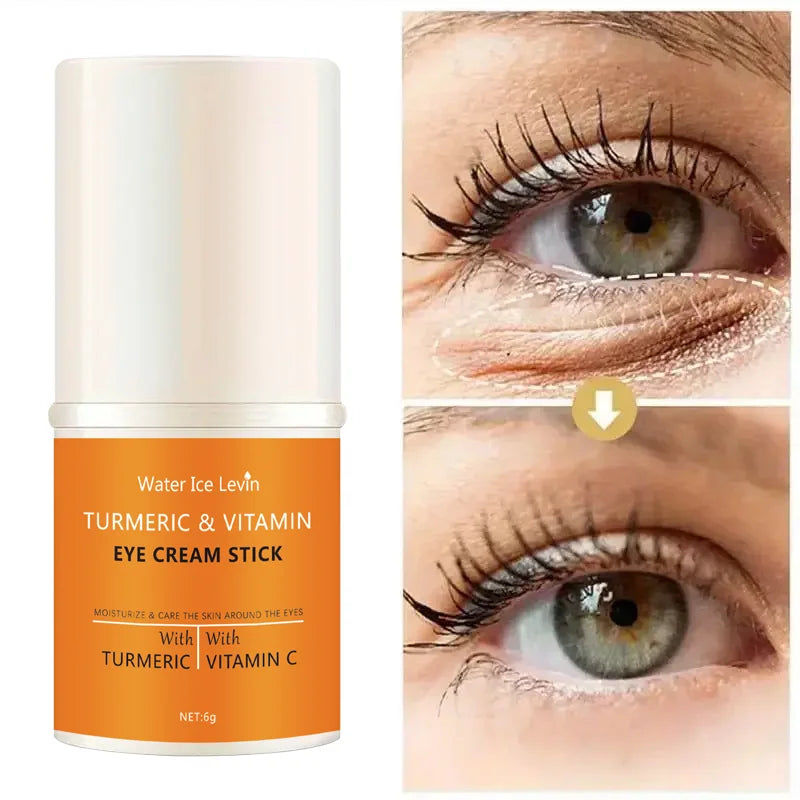 Turmeric vitamin c eye cream stick nourish skin, improve fine lines, relieve eye bags and dark circles, brighten eye skin Qme