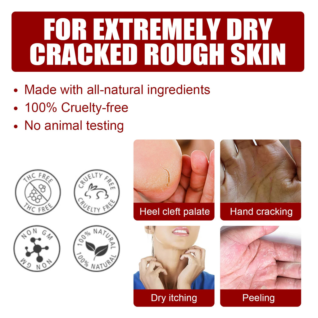 AHA Exfoliating Foot Mask Moisturizing Anti Crack Heel Foot Calluses Dead Skin Remover Smooth & Soft Feet Care Foot Patch Qme