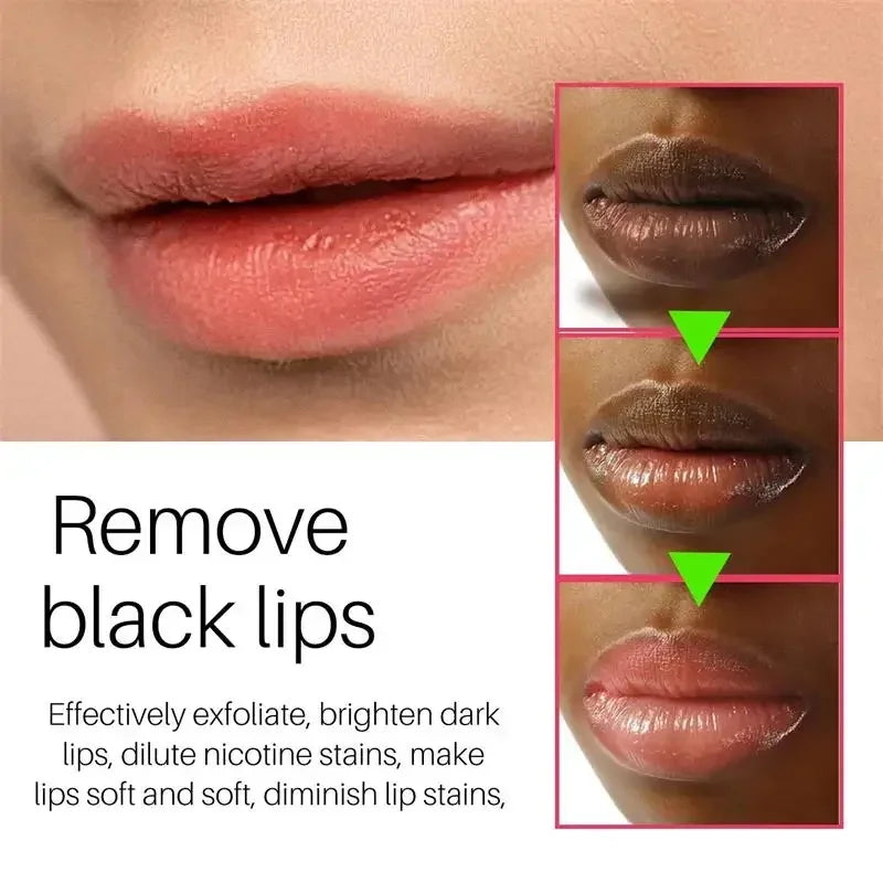 Remove Dark Smoke Lip Balm Lightening Melanin Bleaching Gloss Oil Lips Pink Lipstick Exfoliating Fade Lip Lines Korean Cosmetics Qme
