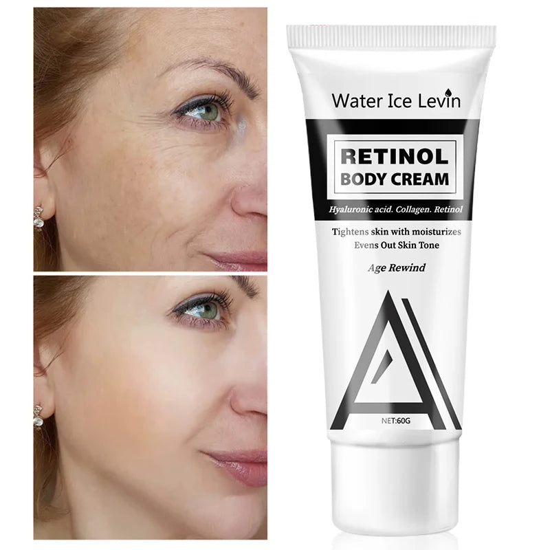 Retinol Body Lotion Firming Moisturizer Wrinkle Cream Boosts Skin Firmness For Face, Body, Dry Skin Improves Elasticity Qme