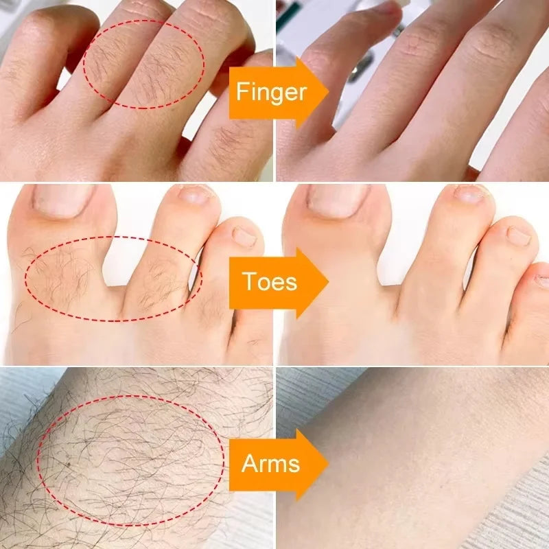3 Minutes Fast Hair Removal Cream Painless Hair Growth Inhibitor Lip Face Arm Armpit Leg Permanent Depilatory for Men Women Care Qme