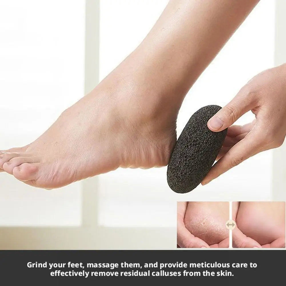 Natural Pumice Stone For Exfoliation - Unscented,Foot & Hand Foot File, Remover For Smooth Feet And Hands, Ideal For Home Use Qme