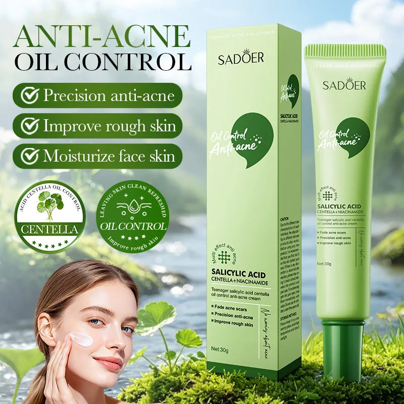 Salicylic Acid Acne Treatment Face Cream Repair Pimple Spots Deep Cleaning Pore Anti-acne Scar Oil Control Moisturizer Skin Care Qme