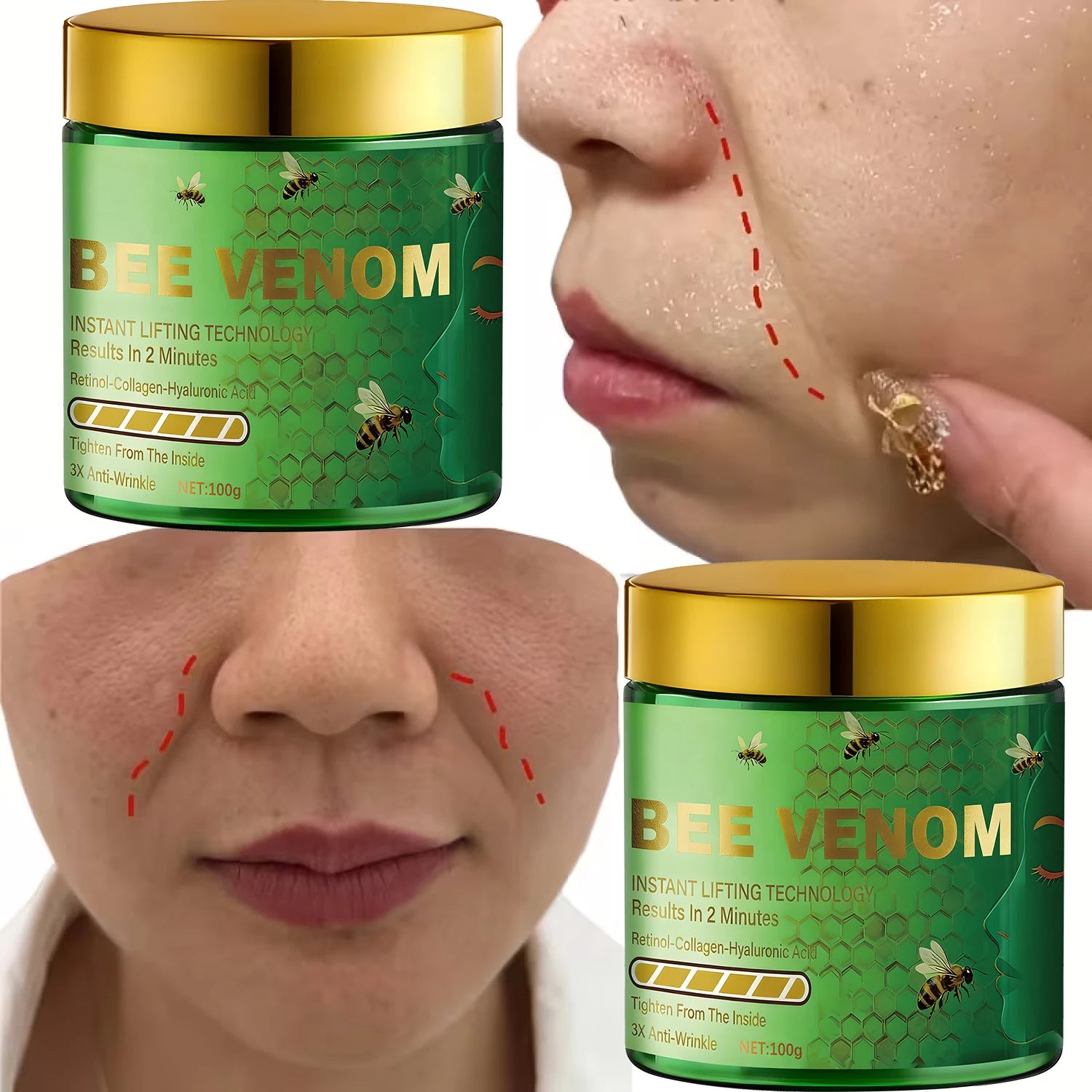 Bee Venom Instant Lifting Cream - 3X Anti-Wrinkle & Tightening Results in 2 Minutes with Retinol & Collagen. Qme