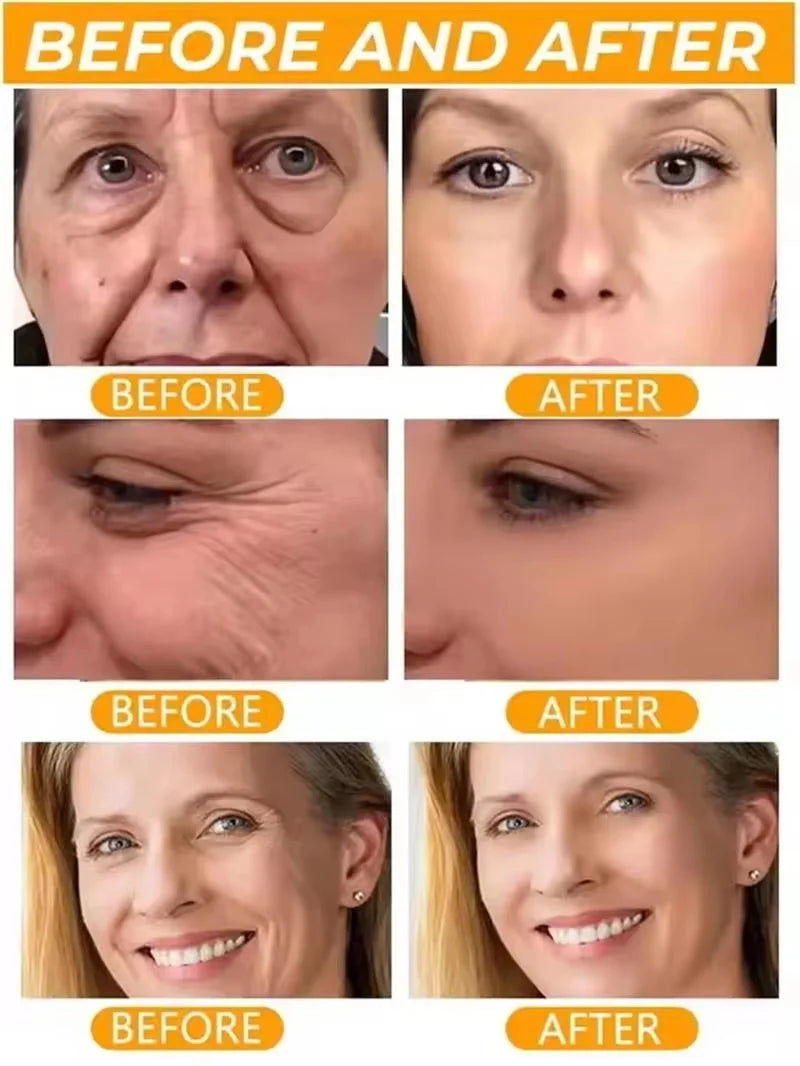 Instant Collagen Protein Threads Lifting Firming Absorbable Face Filler Anti-aging Deep Repair Fade Fine Lines Korean Skincare Qme