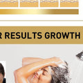 Hair Growth Anti Dandruff Ginger Shampoo Thin Damaged Oil Control Qme one size
