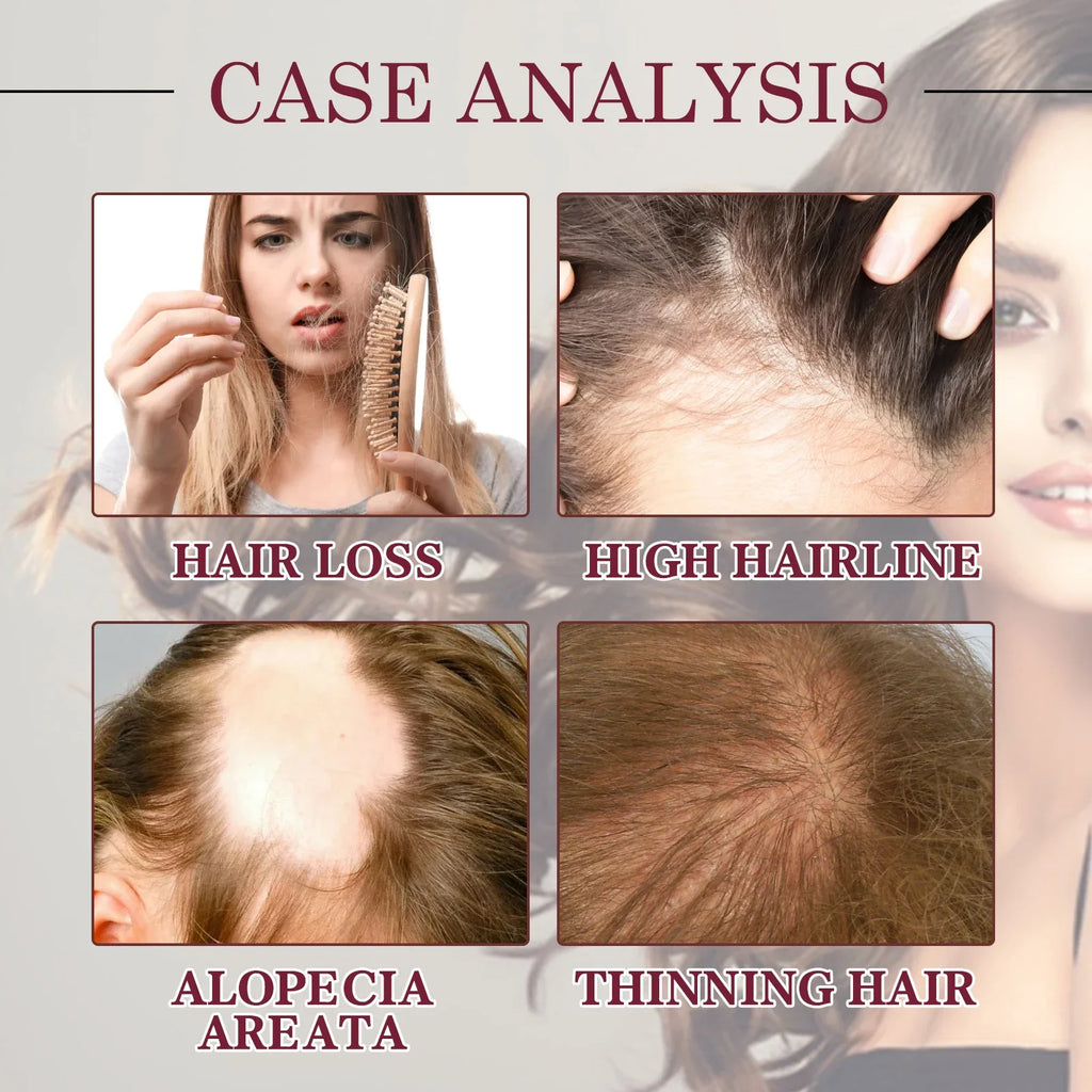 Red Onion Hair Growth Essential Oil Care Spray Prevent Hair Loss Nourish Roots Improve Hair Texture Care Products Qme