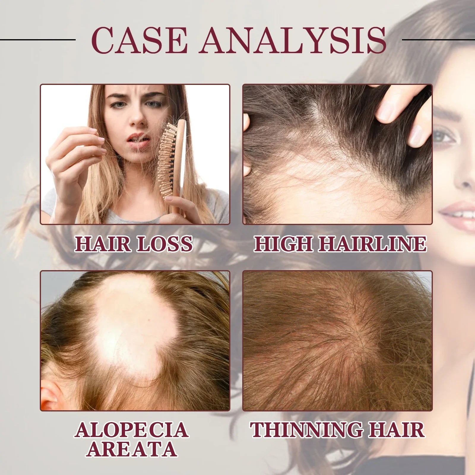Red Onion Hair Growth Essential Oil Care Spray Prevent Hair Loss Nourish Roots Improve Hair Texture Care Products Qme