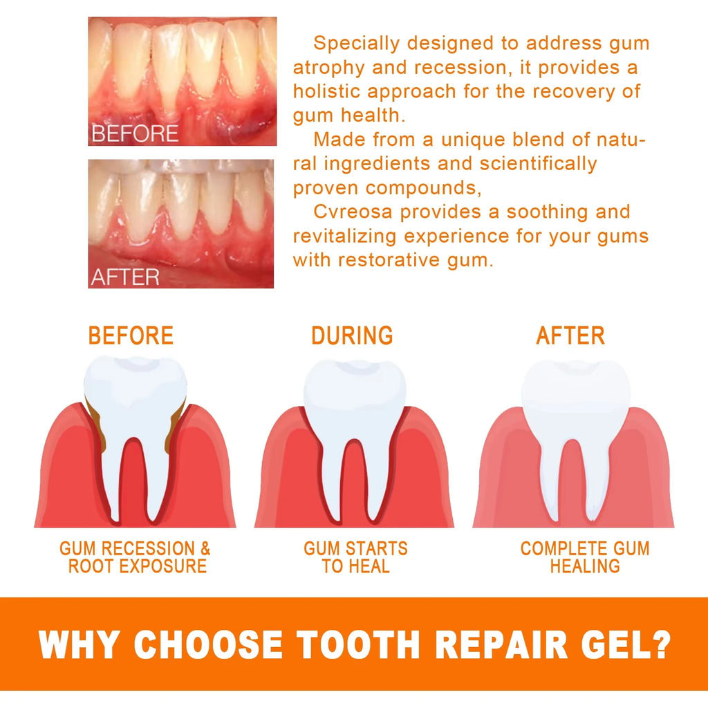 Fast Gum Repair Drops 7 Days Relieve Bleeding Sensitive Gums Soothe Inflammation Repair Gum Line Whiten Teeth Natural Oral Care Qme